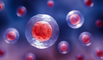 Stem cells reverse woman’s diabetes
