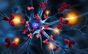 World-first autoimmune disease treatment using donor cells – Dr. Huji Xu